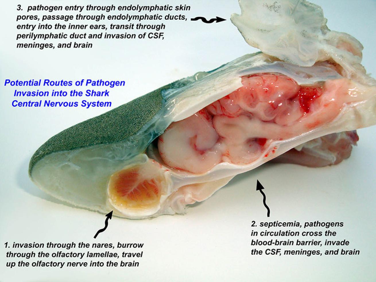 illustration showing the path of the pathogen